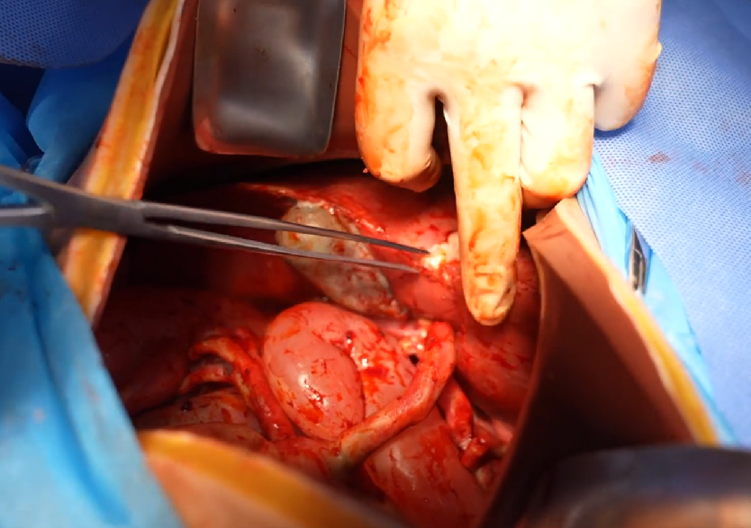 胸腹部損傷控制手術模擬人系統(tǒng)3.0